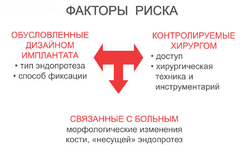 Перипротезный перелом факторы риска